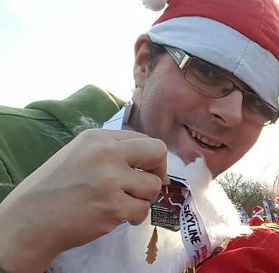 Cosa significa convivere con il disturbo bipolare?